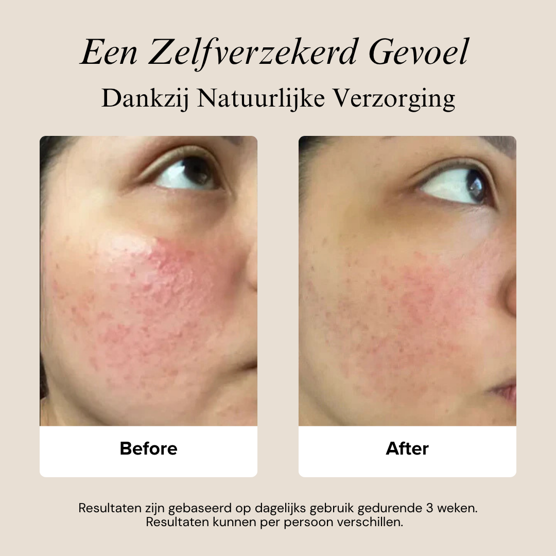 PureGlow Balm